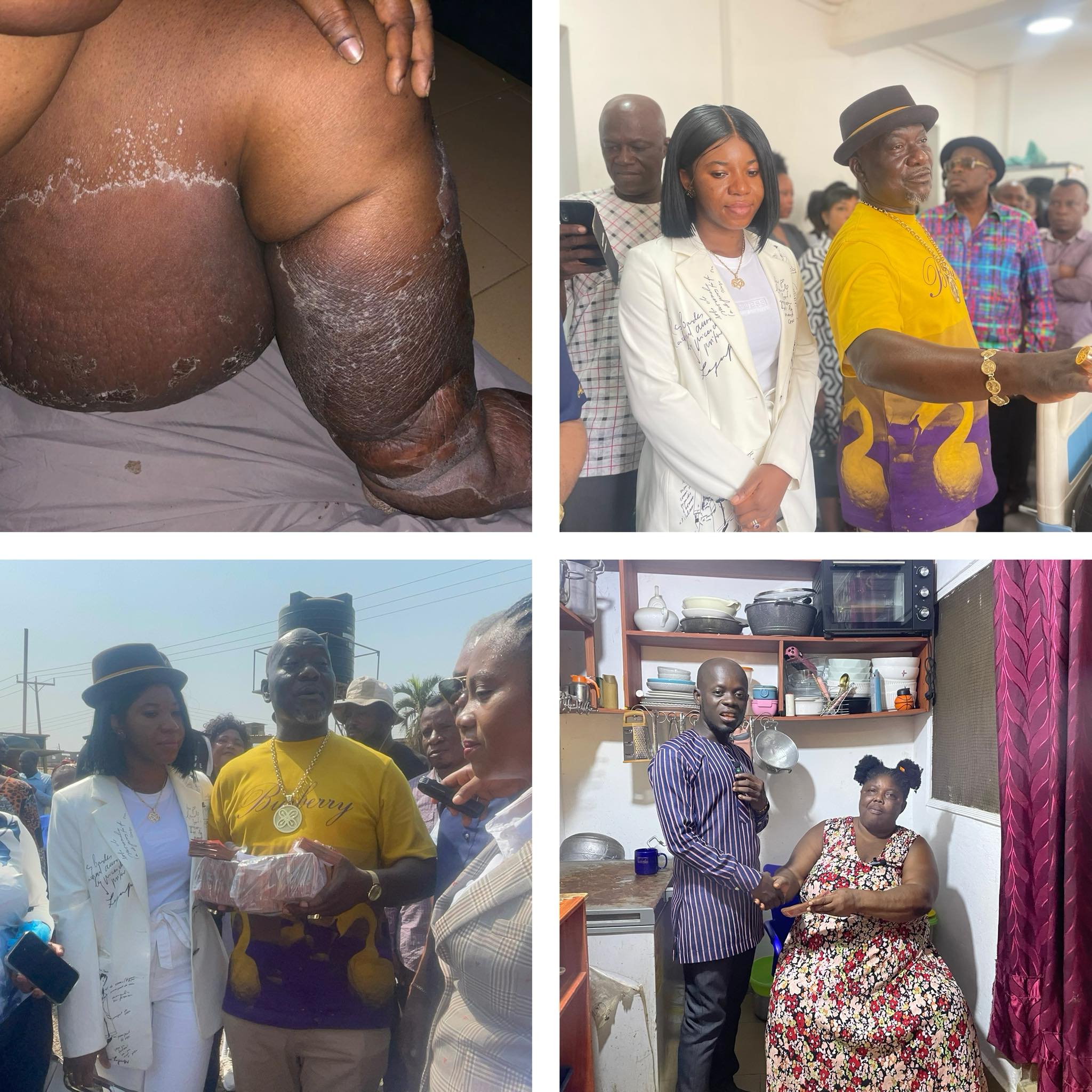 Kofi Job Foundation Donates GH¢10k to Help 52-Year-Old Woman Undergo Life-Changing Surgery