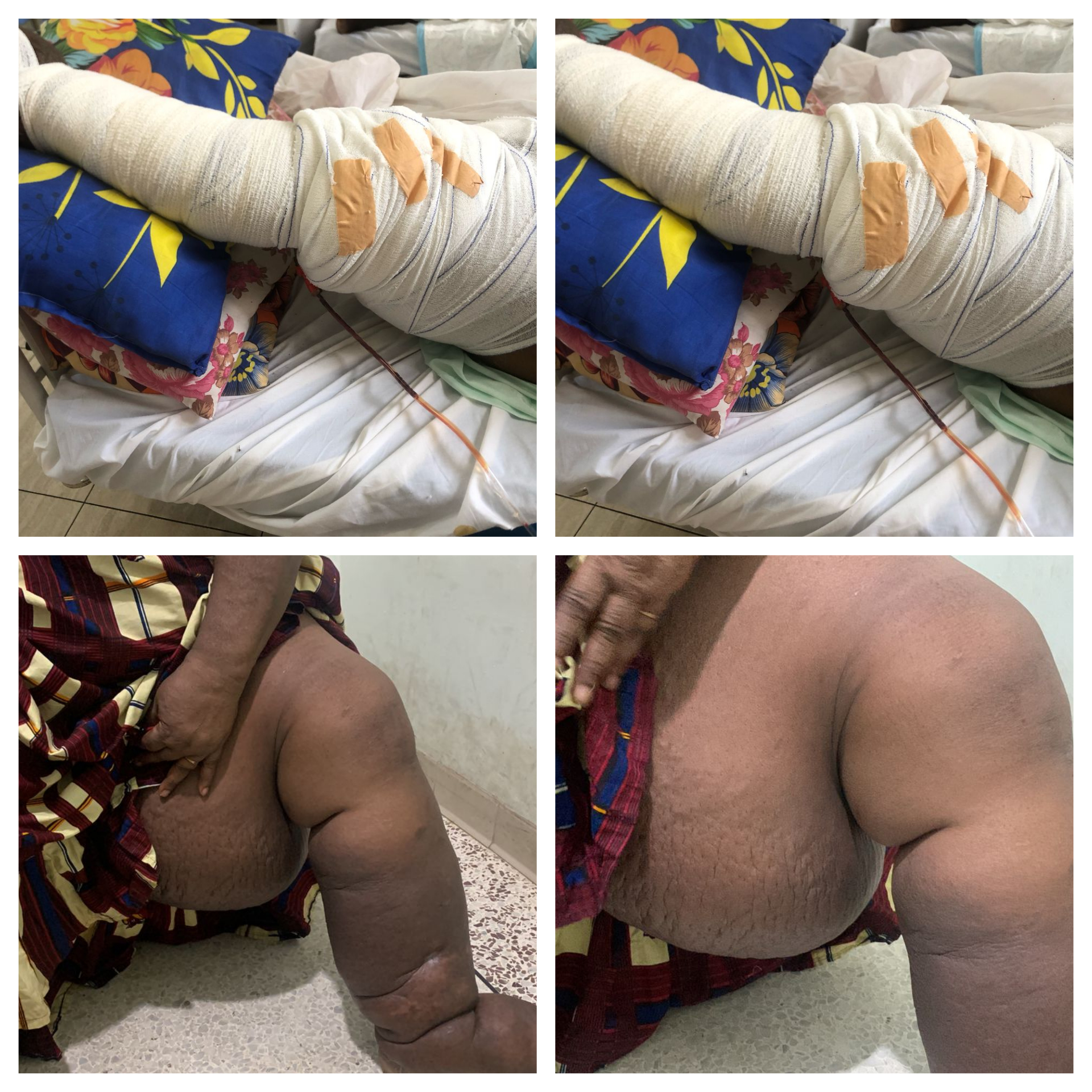 I’m Forever Grateful’ – Woman Saved from Life-Threatening Condition Thanks Kofi Job Foundation
