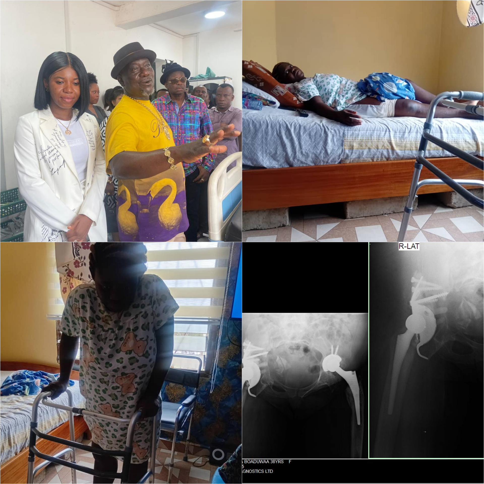 35-Year-Old Woman Completes GH¢100k Surgery Sponsored by Kofi Job Foundation