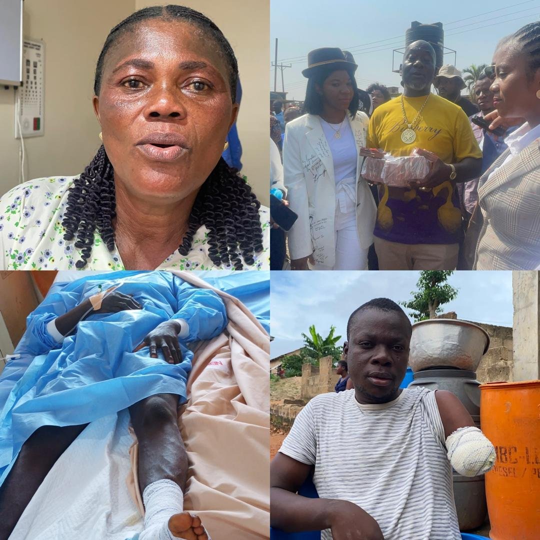 Kofi Job Foundation Funds Surgery For Three Needy Patients At Cost of GH¢50,000